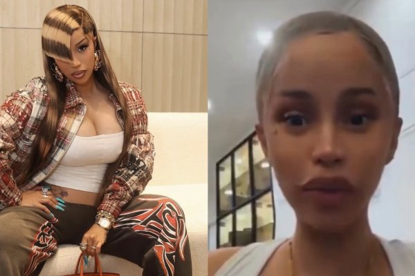 [Cardi B viraliza ao admitir que não lava o cabelo e especialistas alertam para os riscos de descuidar da higiene capilar! ]
