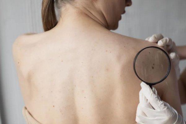 [Câncer é principal causa de morte em 670 cidades brasileiras, diz Observatório de Oncologia]