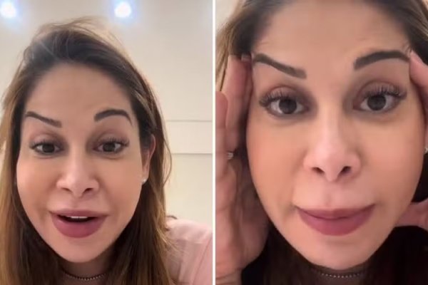 Erro em procedimento estético faz Maira Cardi ficar com sobrancelha torta: [Erro em procedimento estético faz Maira Cardi ficar com sobrancelha torta: