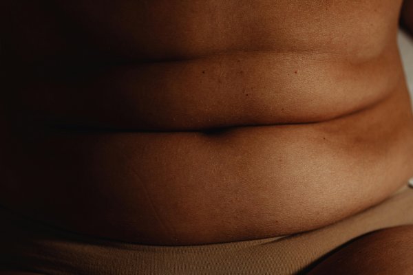 [Gordura na barriga provoca danos cardíacos mais graves do que o peso total, aponta estudo]