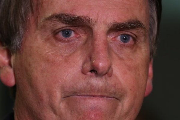 [Procedimento para conter soluços de Bolsonaro é finalizado]