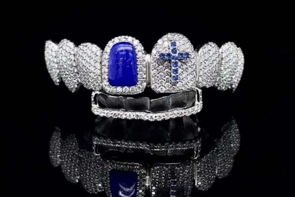 [Joia dental usada por Madonna foi criada por uma profissional brasileira! ]