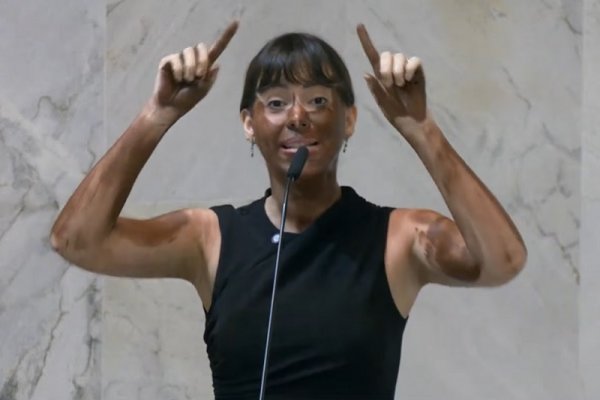 [Deputada usa blackface na Alesp para criticar eleição de Erika Hilton à Comissão dos Direitos  da Mulher]