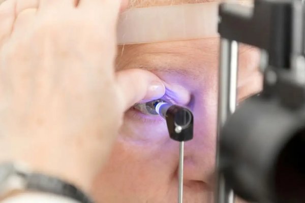 [Mutirão oftalmológico deixa 26 pacientes com problemas na visão em Irecê ]