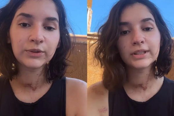 [Mais de 10 facadas: sobrevivente de tentativa de feminicídio fala pela 1° vez; veja]