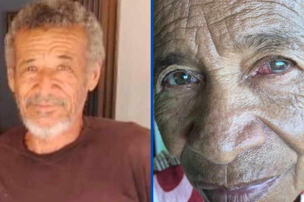 [Fabricante de medicamento usado em mutirão que deixou pacientes cegos na Bahia diz que substância é usada em tratamentos contra câncer]