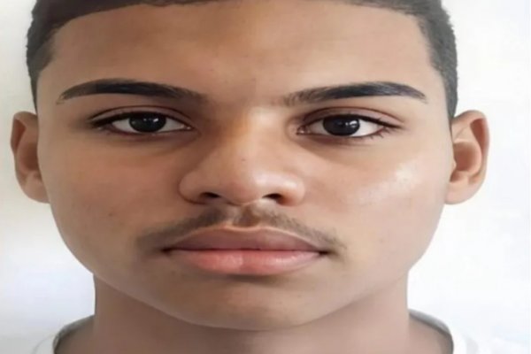 [Adolescente morre após contrair raiva humana decorrente de mordida de sagui]