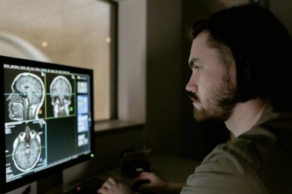 [Maio Cinza: sinais de tumor cerebral vão além da dor de cabeça!]