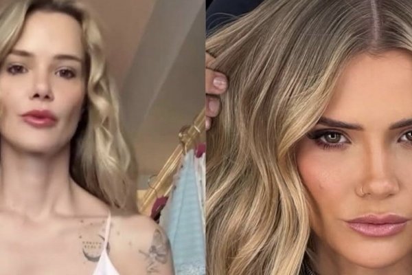 [Marcela Mc Gowan fala sobre “rippling” nas próteses após emagrecimento e especialista explica o efeito! ]