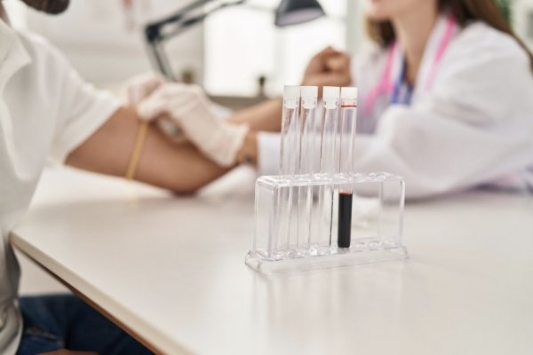 [Exames laboratoriais ajudam a identificar doenças silenciosas antes dos primeiros sintomas! ]