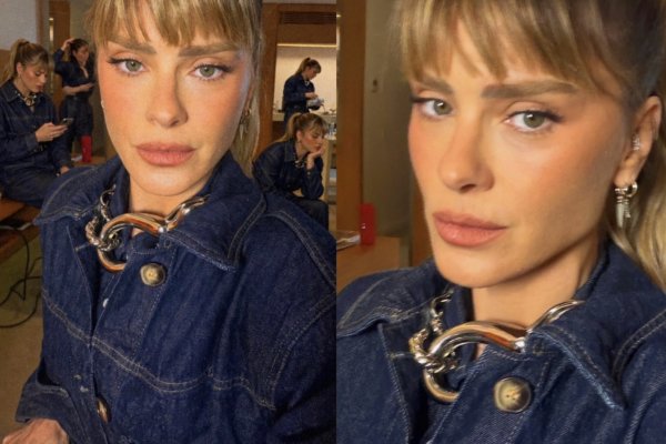 [Carolina Dieckmann aposta em radiofrequência monopolar para cuidar da firmeza da pele sem mudar os traços! ]