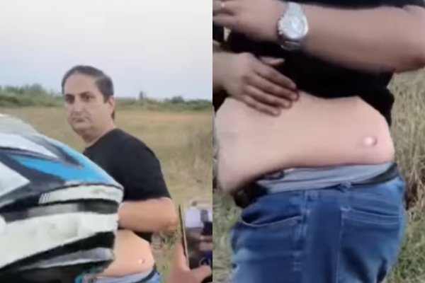 [Vídeo: Candidato ao governo da Bahia é atingido por bala de borracha em manifestação e acusa PM]