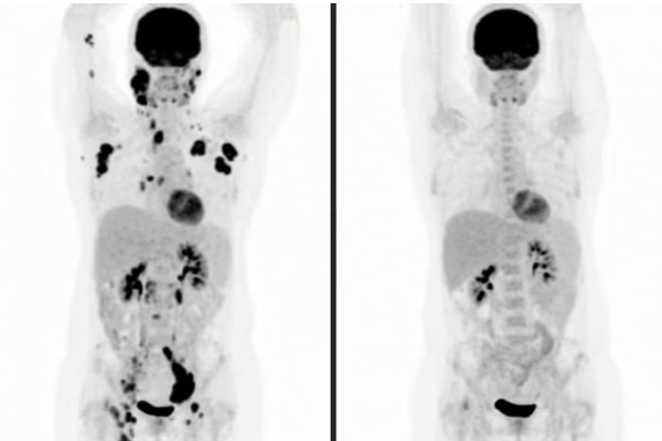 [Brasil vai testar 1ª vacina de mRNA em humanos após aprovação da Anvisa]