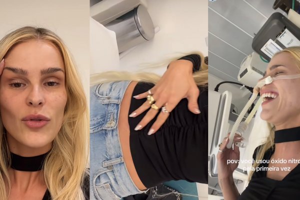 [Yasmin Brunet usa “gás do riso” durante ultrassom microfocado no abdômen! ]