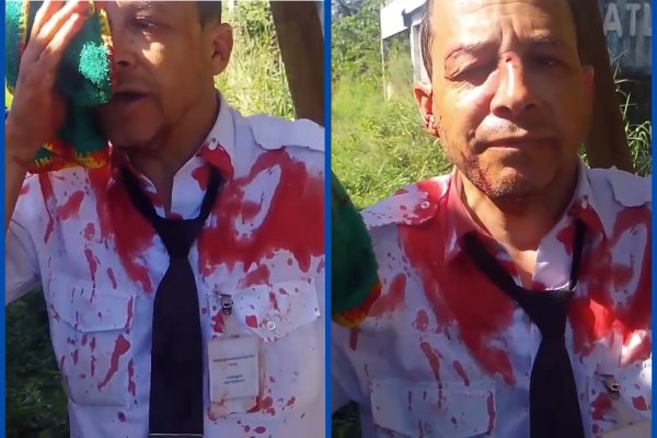 [Cobrador de transporte intermunicipal é agredido por passageiro na Bahia]