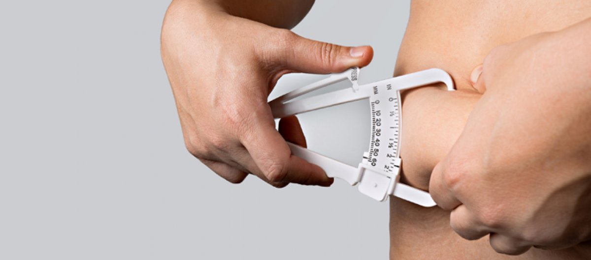 Cirurgia Bariátrica