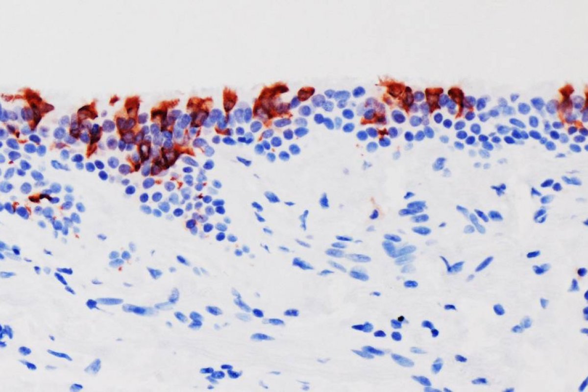 Incidência da Ômicron já é de 31,7% em oito estados do Brasil, diz levantamento
