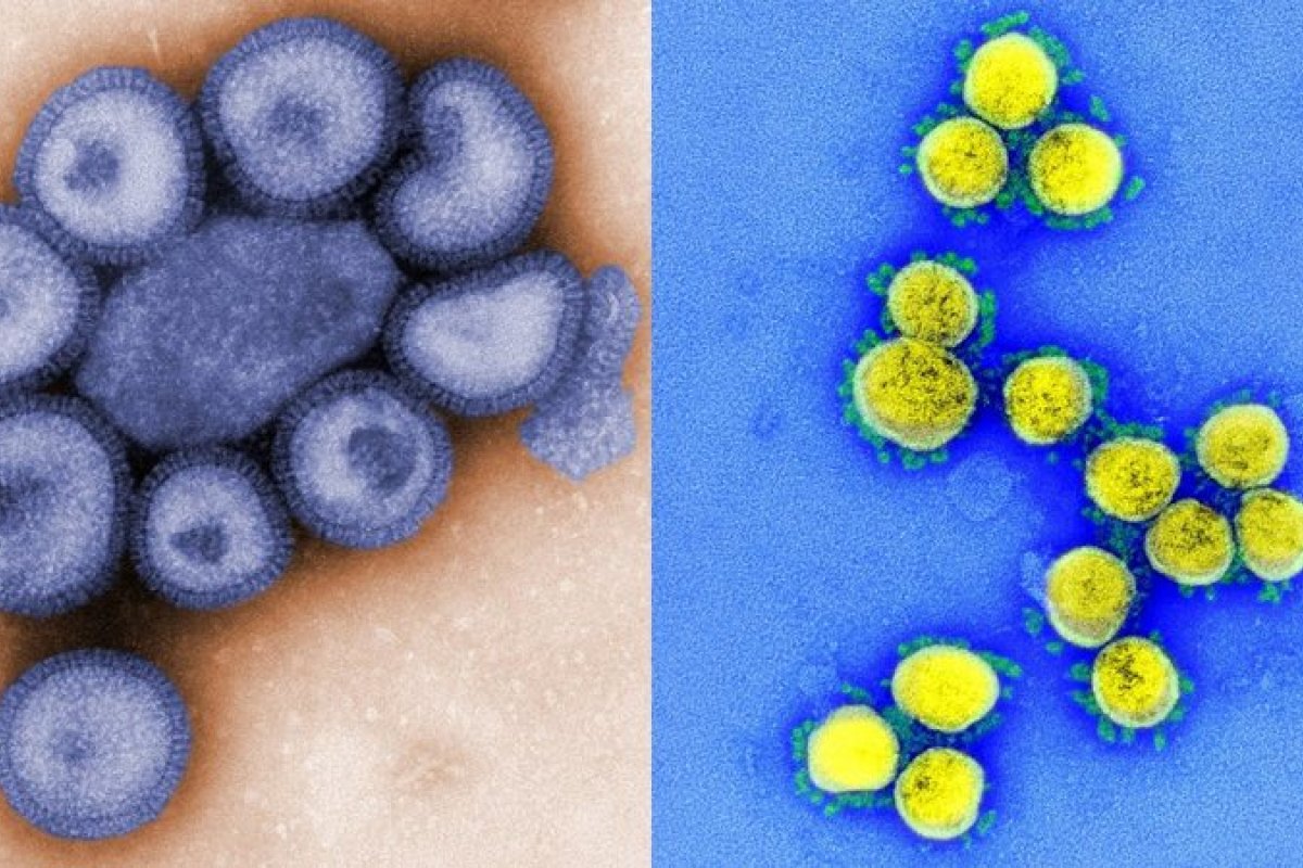 Flurona: Fortaleza contabiliza três casos da coinfecção da gripe e Covid-19