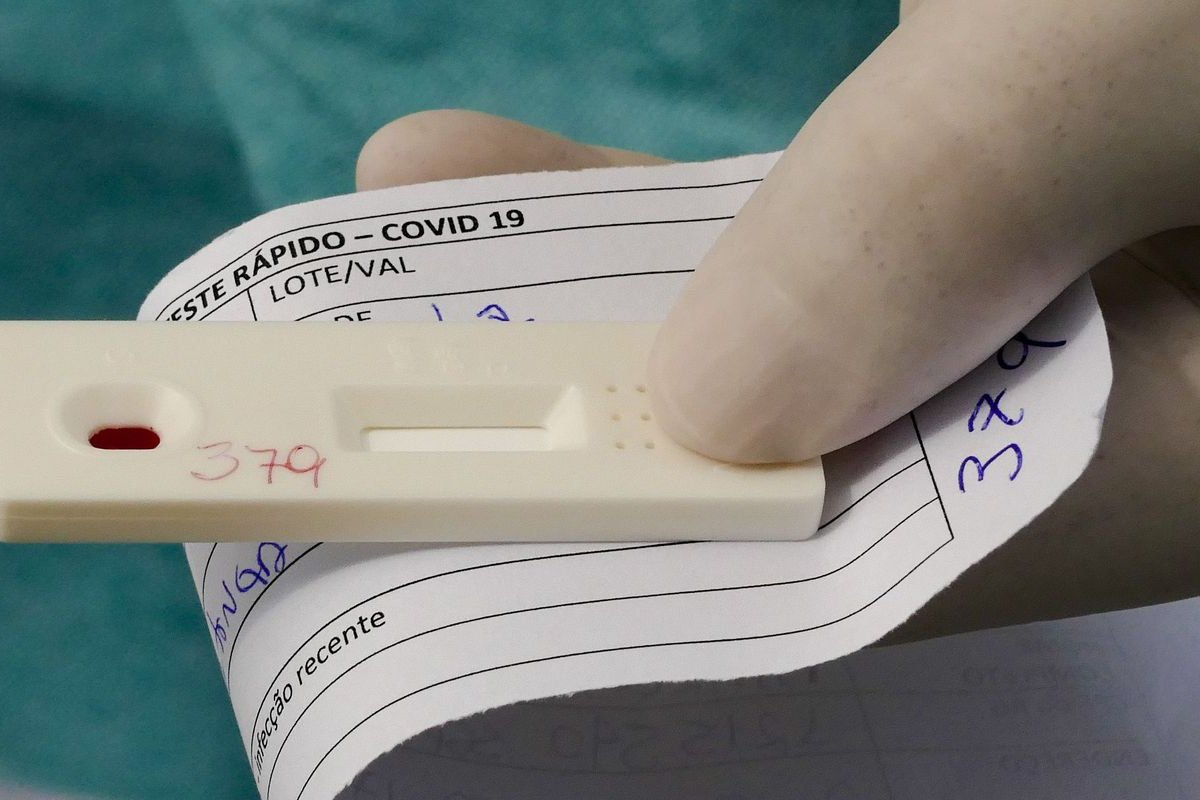 Segundo caso de infecção pela Ômicron é confirmado no Rio de Janeiro