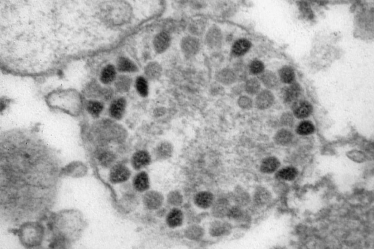 Primeira vítima da Ômicron no Brasil morreu na UTI cinco dias após caso ser notificado