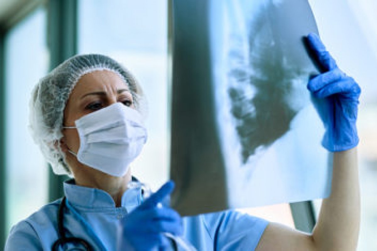 Brasil pode chegar a ter 1 milhão de casos diários de Covid-19, aponta estudo