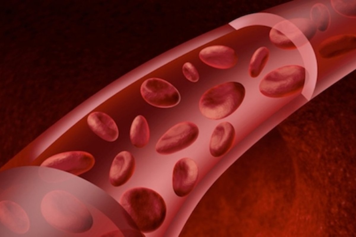 Anticoagulante pode ser usado no tratamento da 'covid-longa', diz pesquisa