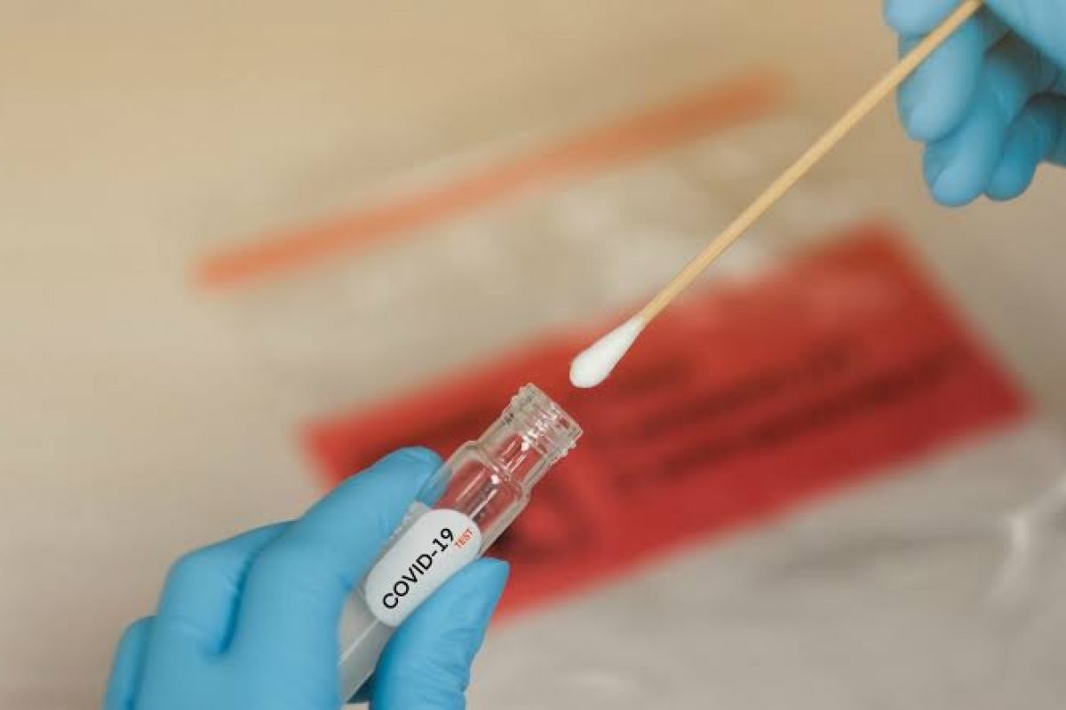 Demanda de farmácias por combo de teste rápido para Covid-19 e Influenza aumentou cerca de 150 vezes em dezembro