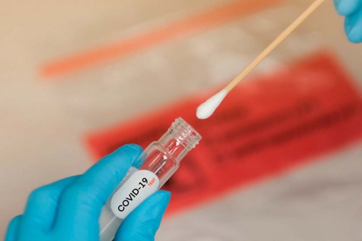 Um em cada 10 brasileiros já se infectaram com Covid-19 no país