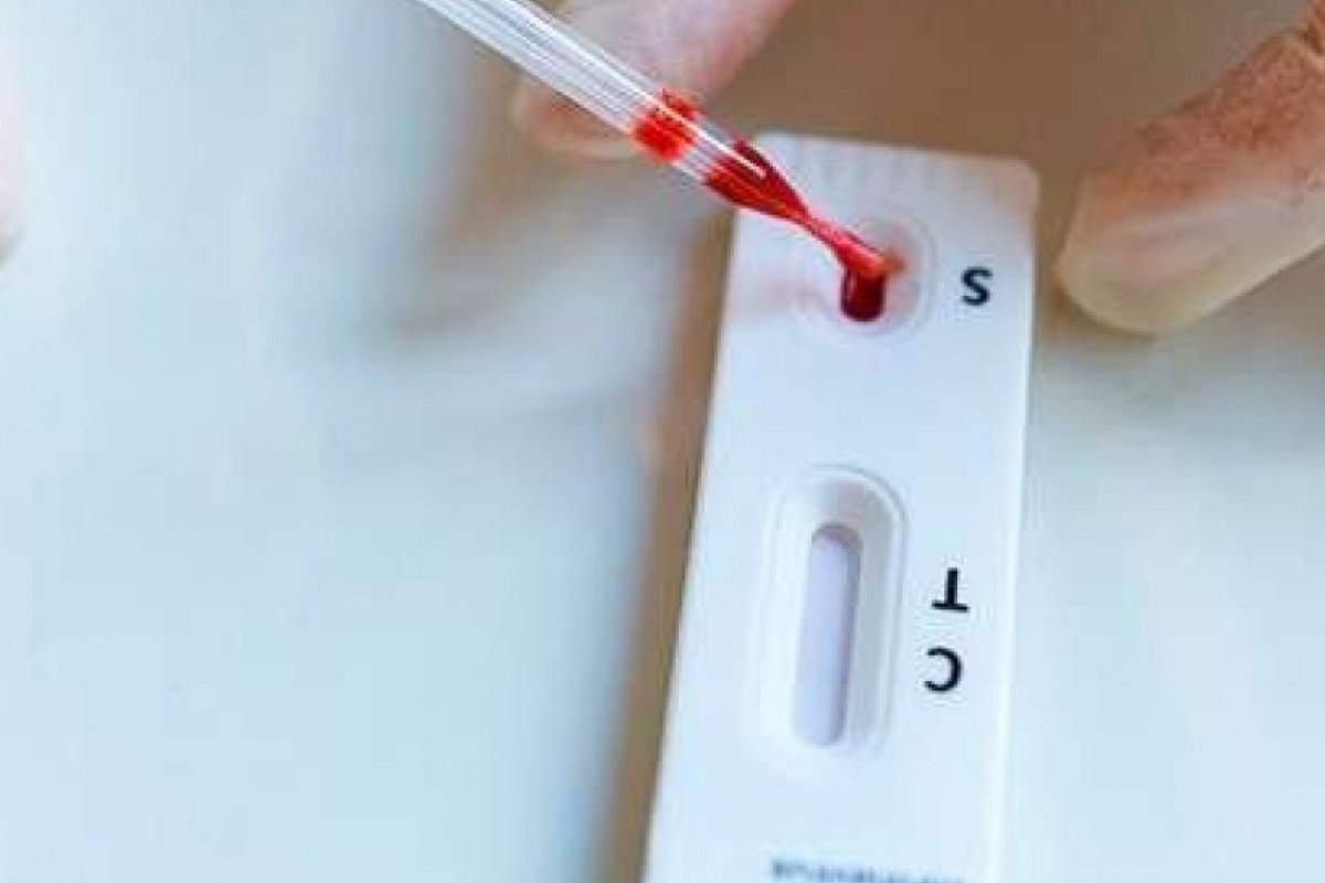 Testes positivos para Covid-19 na 1ª semana de janeiro já superam dezembro de 2021