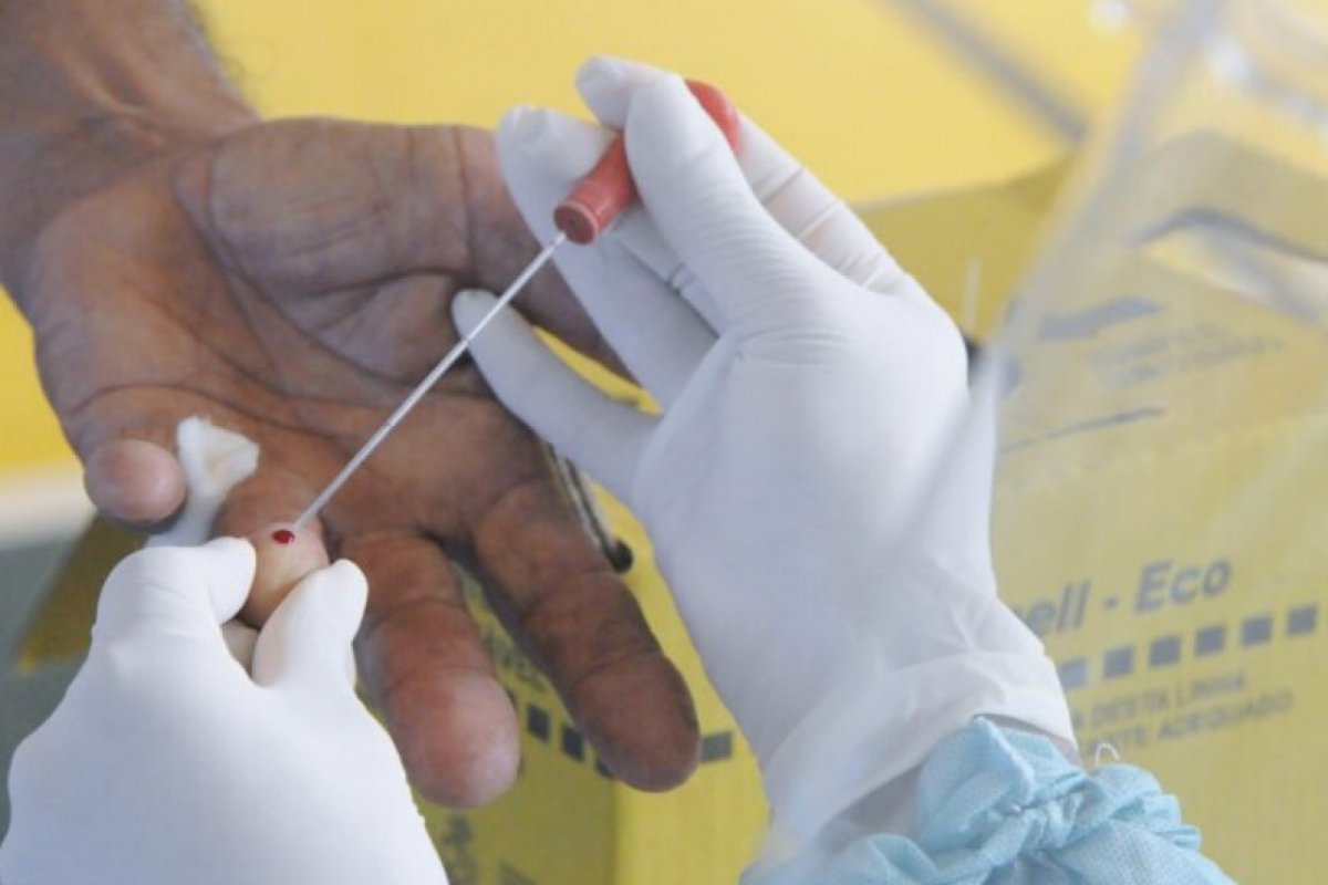 Ministério da Saúde nega responsabilidade sobre eventual escassez de testes de Covid-19