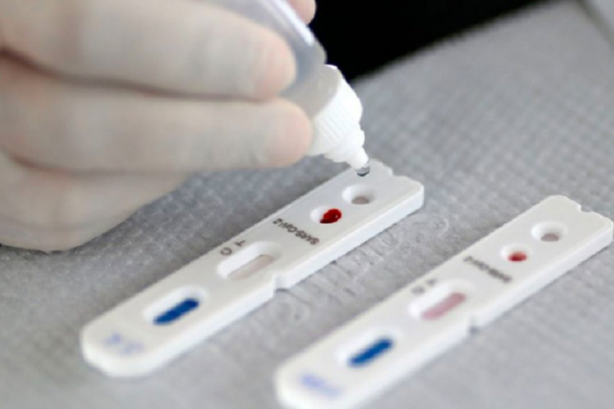 Saúde pede autorização à Anvisa para autoteste de Covid-19