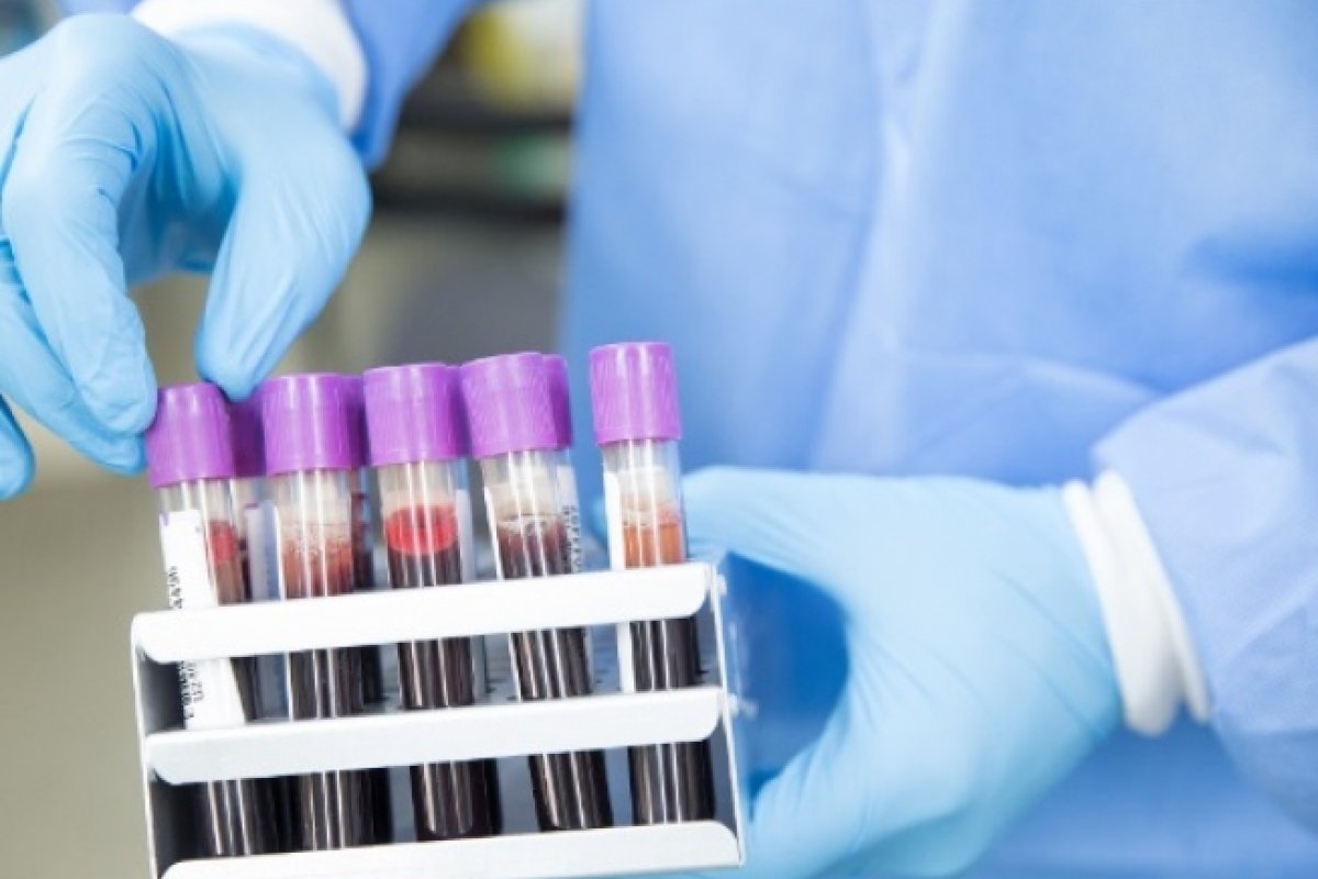 Bahia registra 2.430 novos casos de Covid-19 nas últimas 24h