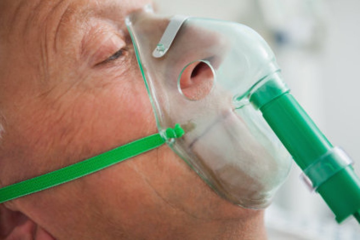 Casos de Síndrome Respiratória Grave sobem 135% em todo país