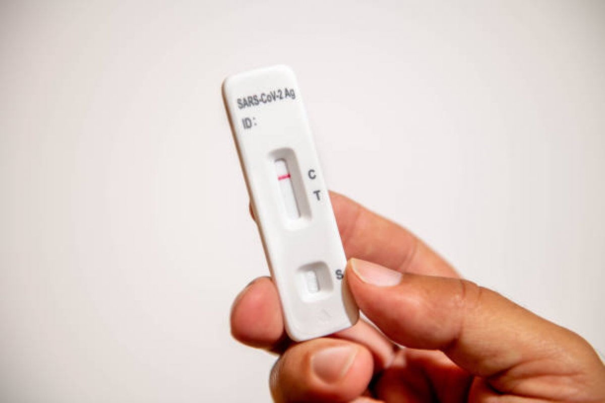 Autotestes de Covid-19: Anvisa decide liberação nesta quarta-feira (19)