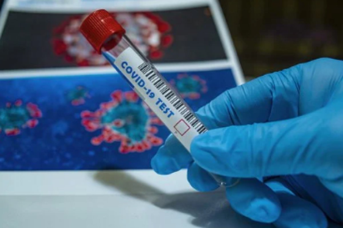 Com mais 3,8 mil novos positivos, Bahia registra quase 15 mil casos ativos de Covid-19