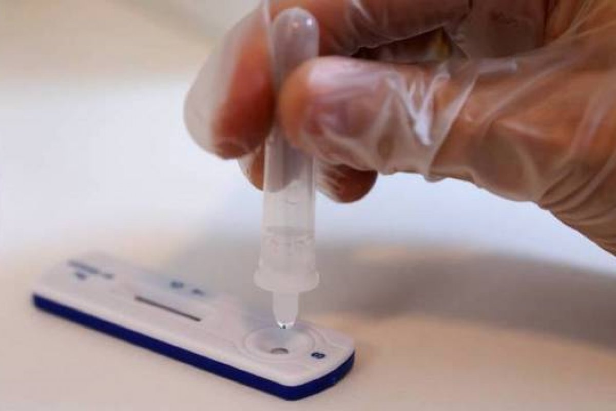 Covid-19: buscas por testes aumentam cinco vezes em um mês, afirma levantamento