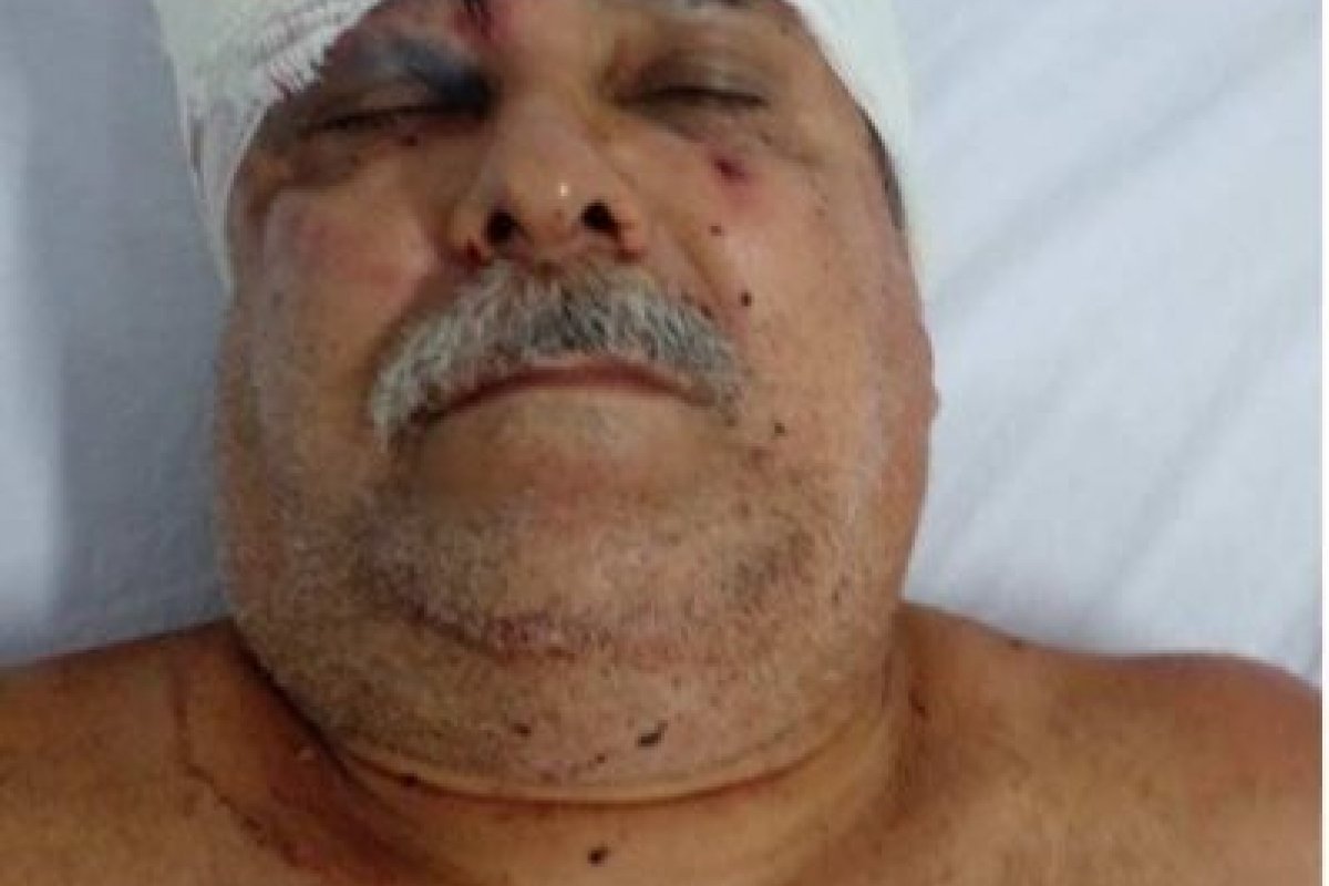 Idoso de 62 anos é agredido a pauladas dentro de casa; Sobrinhos são suspeitos