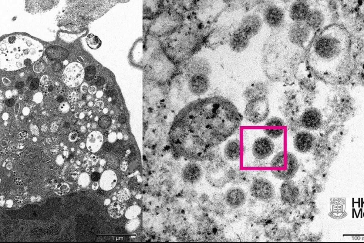Ômicron sobrevive por mais tempo na pele e em superfícies plásticas, diz estudo