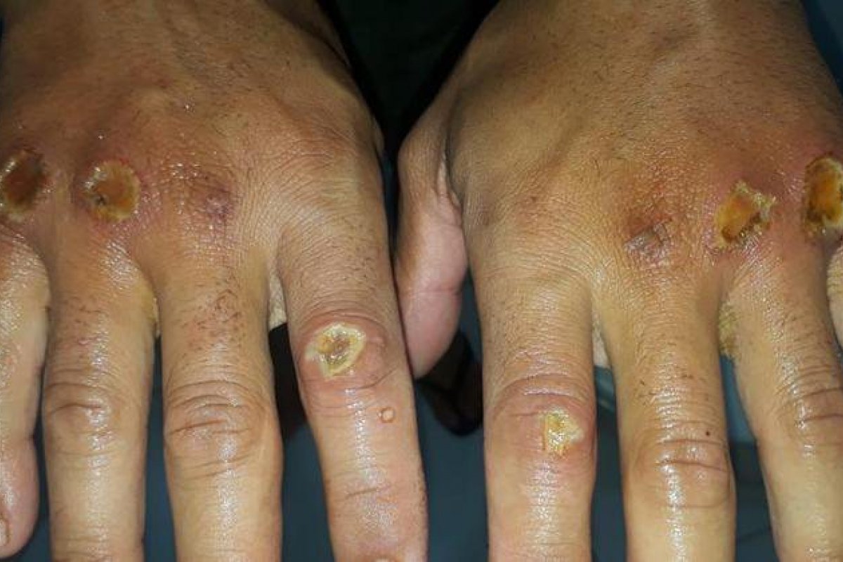 Policiais penais denunciam agressões durante treinamento para o Comando de Operações Especiais de Minas Gerais