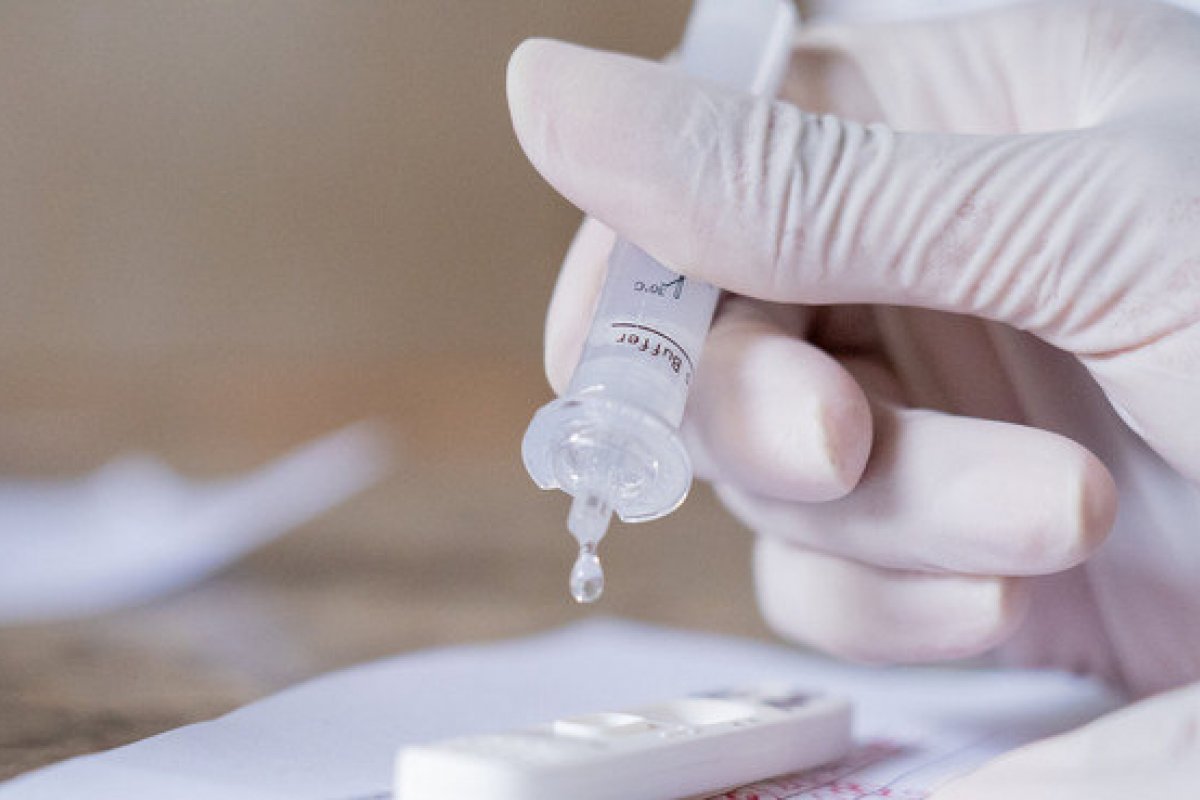 Anvisa autoriza venda de autotestes de Covid-19; empresas terão que solicitar registro dos produtos