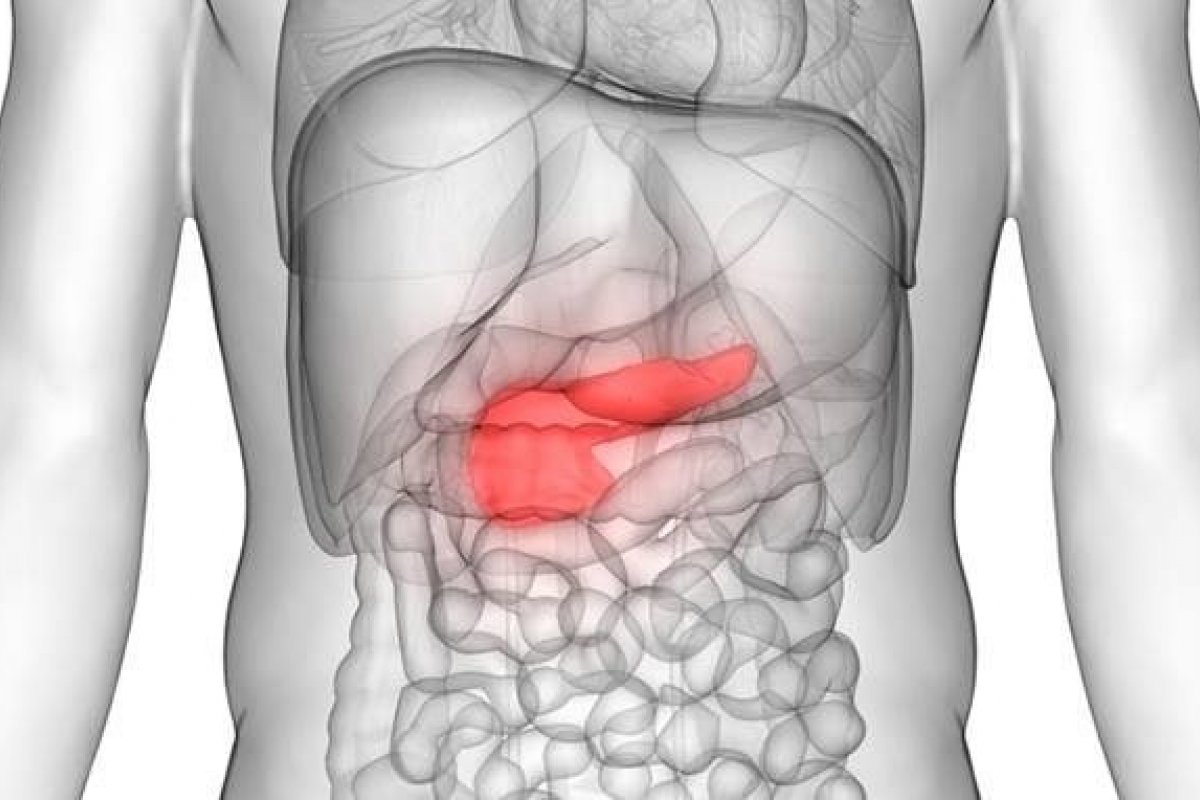 Estudo aponta que câncer no pâncreas 'se alimenta' de ácido hialurônico
