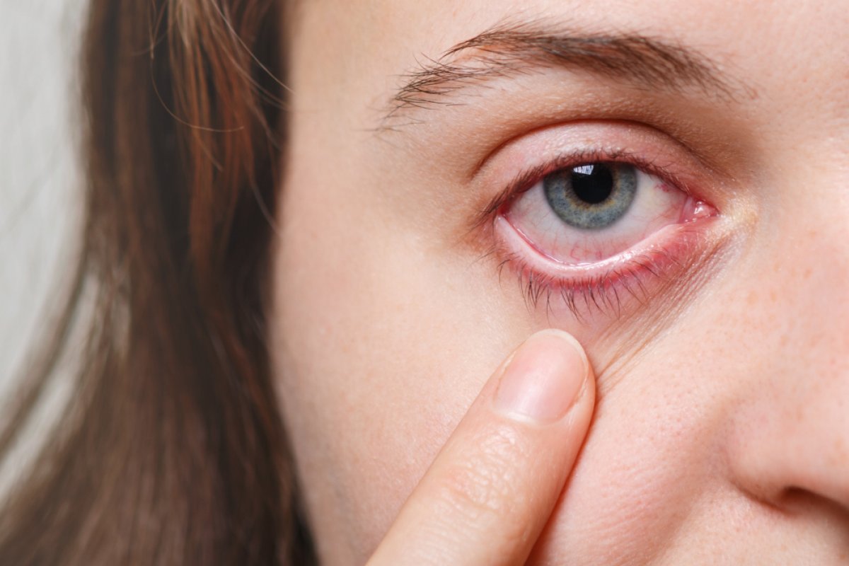 Doenças oculares aumentam 20% no Verão 