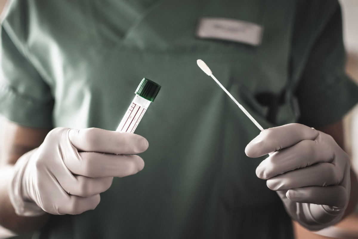 Taxa de resultados positivos em teste de laboratório sobe para 60%