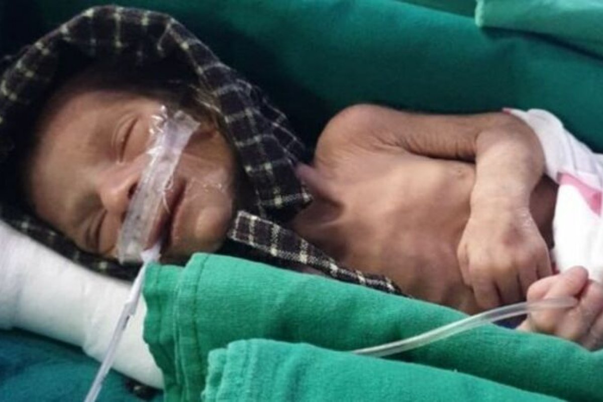 Bebé enterrada viva é encontrada por pai que sepultava filha morta após o parto