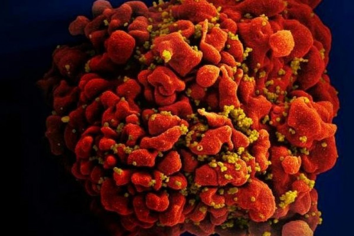 Estudo internacional aponta descoberta de variante mais transmissível do HIV