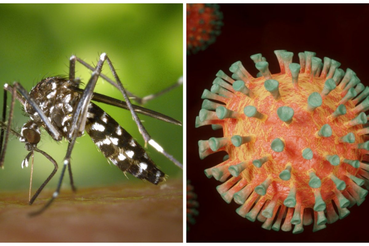 Você sabe diferenciar os sintomas da dengue dos da Covid-19? Veja como fazer isso