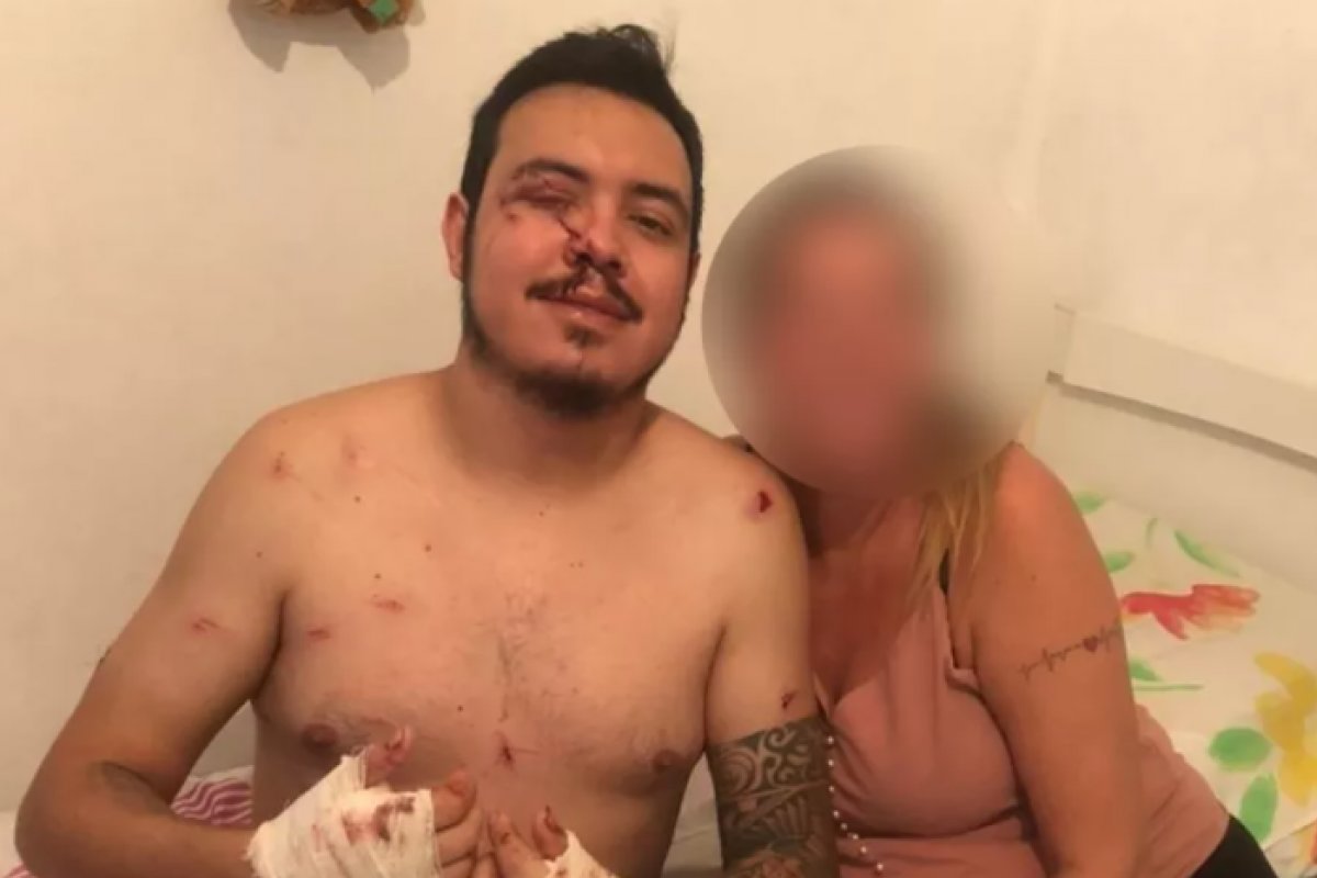 Filho deixa hospital após salvar a mãe e ser esfaqueado pelo ex-companheiro dela em Itanhaém, no litoral de SP