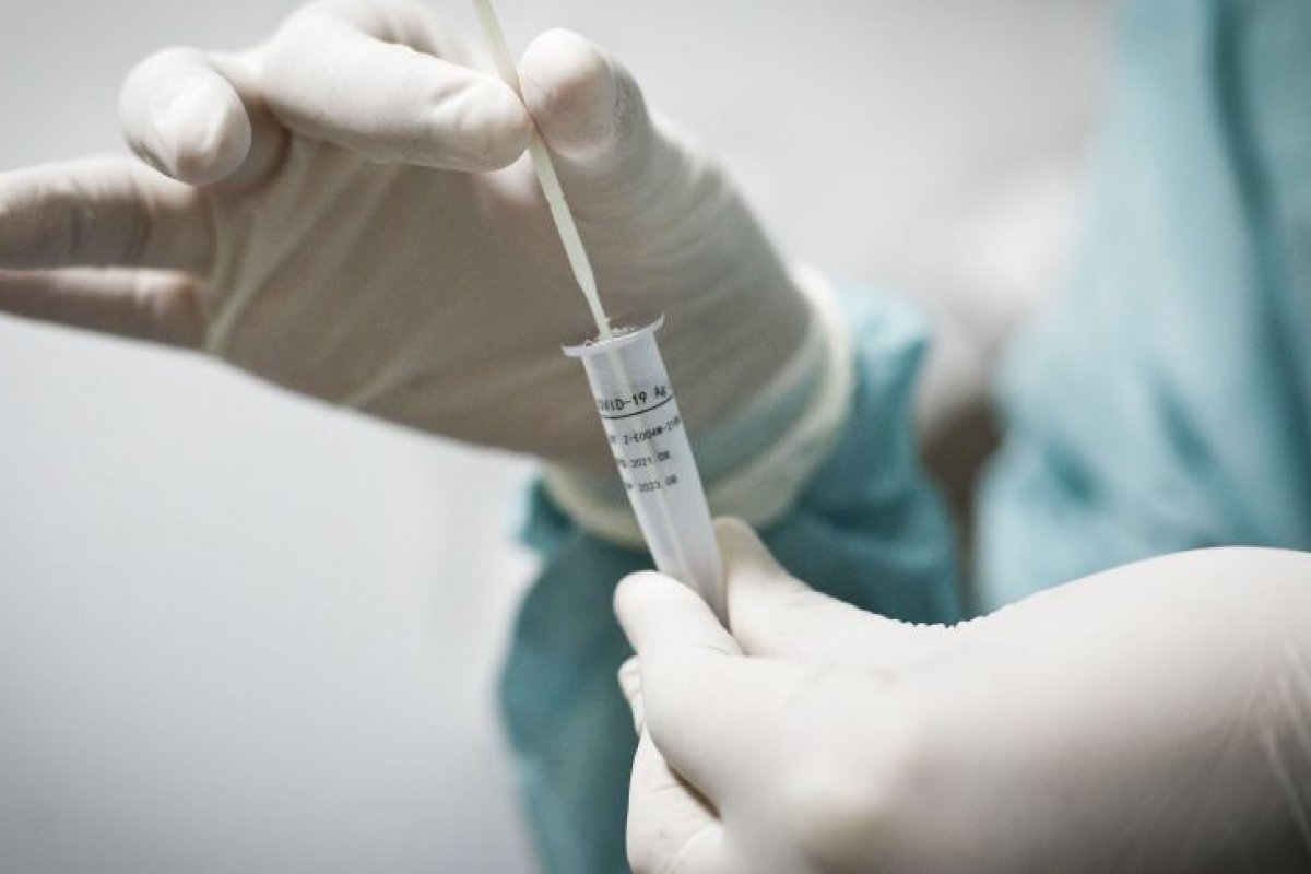 Testes de Covid-19 realizados em laboratórios poderão ser abatidos do Imposto de Renda