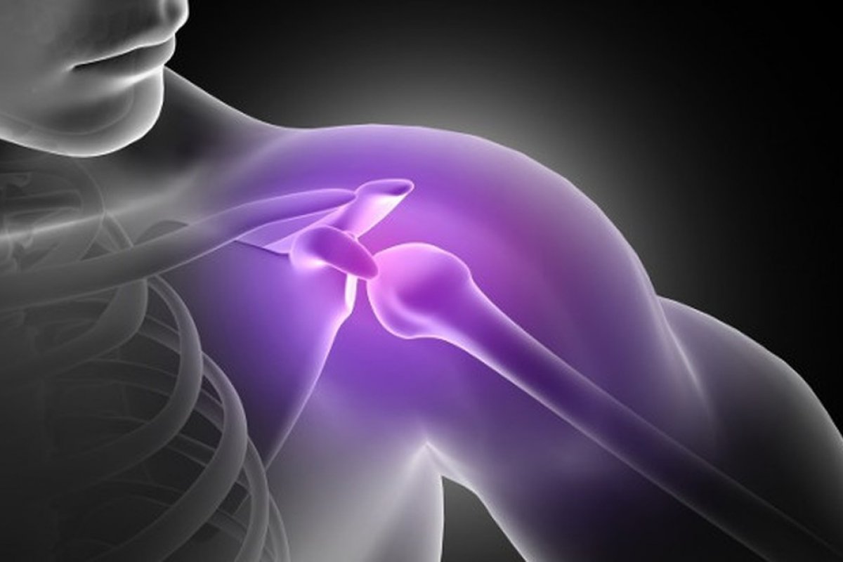 Dor nos ombros pode estar ligada à capsulite adesiva