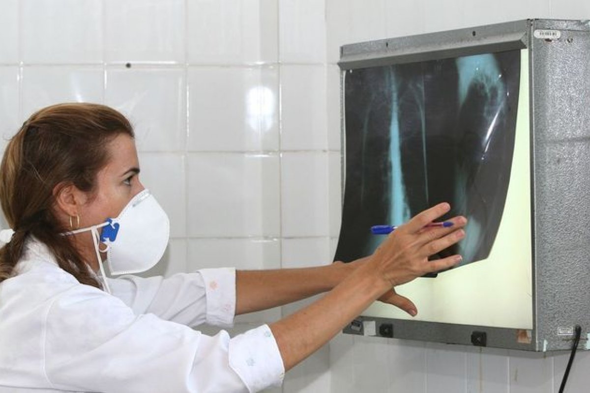 Ministério da Saúde aprova plano de combate da tuberculose